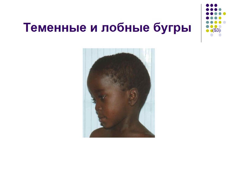 Теменные и лобные бугры      (53)